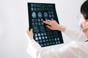 Example of an MRI scan